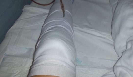 Lekár napriek škandálu s kolenom vo Fakultnej nemocnici zostal