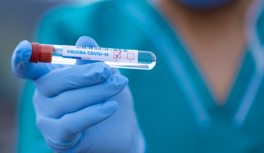 Máte pozitívny výsledok testu na koronavírus? Takto by ste mali postupovať