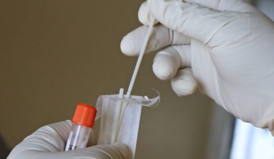 Radnica sa pripravuje na testovanie, chýbajú však informácie
