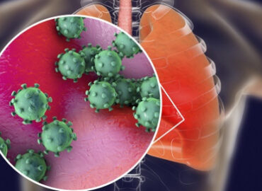 Situácia v Nitrianskom kraji vo výskyte chrípky a respiračných ochorení